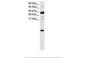Image no. 1 for anti-Chemokine (C-X-C Motif) Ligand 1 (Melanoma Growth Stimulating Activity, Alpha) (CXCL1) (C-Term) antibody (ABIN6736034) (CXCL1 抗体  (C-Term))