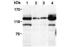Western Blotting (WB) image for anti-Signal-Induced Proliferation-Associated 1 (SIPA1) antibody (ABIN1449260) (SIPA1 抗体)