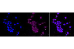 Immunocytochemical staining of HAP-1 cells with Cleaved PARP antibody (ABIN7799865), 1:1,000).