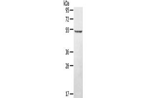 Western Blotting (WB) image for anti-serine/threonine/tyrosine Kinase 1 (STYK1) antibody (ABIN2427348) (STYK1 抗体)