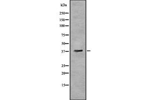 Western blot analysis OR5T3 using HeLa whole cell lysates (OR5T3 抗体)