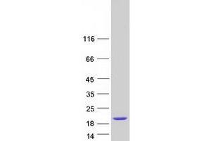 Western Blotting (WB) image for Coiled-Coil Domain Containing 153 (CCDC153) (Coiled coil domain) protein (Myc-DYKDDDDK Tag) (ABIN2712958)
