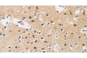 Immunohistochemistry of paraffin-embedded Human brain tissue using FASTK Polyclonal Antibody at dilution 1:30 (FASTK 抗体)