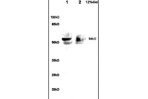 Lane 1: rat brain lysates Lane 2: human colon carcinoma lysates probed with Anti A1BG Polyclonal Antibody, Unconjugated  at 1:200 in 4˚C. (A1BG 抗体  (AA 301-400))