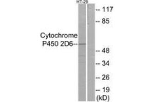 Western blot analysis of extracts from HT-29 cells, using Cytochrome P450 2D6 Antibody. (CYP2D6 抗体  (AA 251-300))