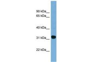 Image no. 1 for anti-Carbonyl Reductase 1 (CBR1) (AA 107-156) antibody (ABIN6744809) (CBR1 抗体  (AA 107-156))