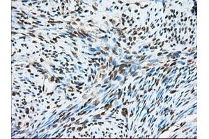 Immunohistochemical staining of paraffin-embedded Human liver tissue using anti-MTRF1L mouse monoclonal antibody. (MTRF1L 抗体)