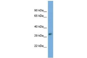 Host:  Rabbit  Target Name:  FKTN  Sample Type:  721_B Whole cell lysates  Antibody Dilution:  1. (Fukutin 抗体  (C-Term))