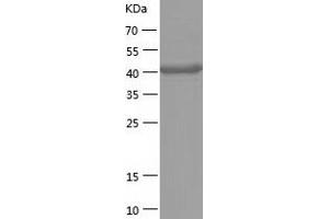 Western Blotting (WB) image for Aminoacylase 1 (ACY1) (AA 1-408) protein (His tag) (ABIN7121810) (Aminoacylase 1 Protein (ACY1) (AA 1-408) (His tag))