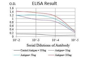 Black line: Control Antigen (100 ng), Purple line: Antigen(10 ng), Blue line: Antigen (50 ng), Red line: Antigen (100 ng), (Nibrin 抗体  (AA 467-615))