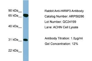 WB Suggested Anti-HIRIP3  Antibody Titration: 0. (HIRIP3 抗体  (Middle Region))