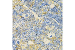 Immunohistochemistry of paraffin-embedded mouse spleen using GPX4 Antibody (ABIN5970997) at dilution of 1/200 (40x lens). (GPX4 抗体)