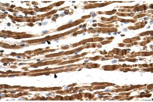 Human Muscle (NARG1L 抗体  (Middle Region))