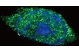 Confocal immunofluorescent analysis of JAK2 antibody with HeLa cells followed by Alexa Fluor 488-conjugated goat anti-rabbit lgG (green). (JAK2 抗体  (AA 1101-1132))