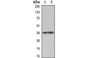 Western blot analysis of TEL2 expression in A431 (A), Hela (B) whole cell lysates. (ETV7 抗体)