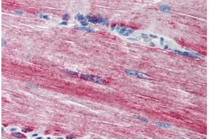 Human Skeletal Muscle (formalin-fixed, paraffin-embedded) stained with ACSL3 antibody ABIN301660 at 20 ug/ml followed by biotinylated goat anti-rabbit IgG secondary antibody ABIN481713, alkaline phosphatase-streptavidin and chromogen. (Acsl3 抗体  (N-Term))
