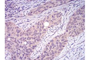 Immunohistochemistry (IHC) image for anti-TNF Receptor-Associated Factor 2 (TRAF2) (AA 39-188) antibody (ABIN5896378) (TRAF2 抗体  (AA 39-188))