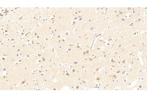 Immunohistochemistry (IHC) image for anti-Enolase 2 (Gamma, Neuronal) (ENO2) (AA 2-285) antibody (ABIN7437977)