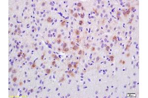 Immunohistochemistry (IHC) image for anti-Epidermal Growth Factor Receptor Pathway Substrate 8 (EPS8) (AA 251-350) antibody (ABIN705011)
