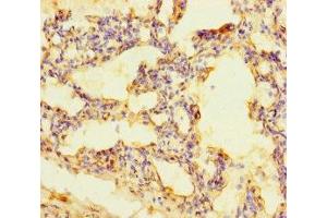 Immunohistochemistry of paraffin-embedded human lung tissue using ABIN7168465 at dilution of 1:100 (RUFY4 抗体  (AA 174-473))