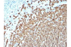 Formalin-fixed, paraffin-embedded human Tonsil stained with CD20 Mouse Monoclonal Antibody (MS4A1/3411). (CD20 抗体  (AA 213-297))