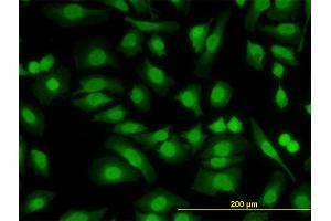 Immunofluorescence (IF) image for anti-PBX/knotted 1 Homeobox 2 (PKNOX2) (AA 116-215) antibody (ABIN566219)