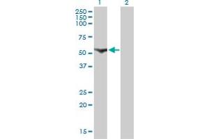 Western Blot analysis of CDADC1 expression in transfected 293T cell line by CDADC1 monoclonal antibody (M01), clone 1A2.