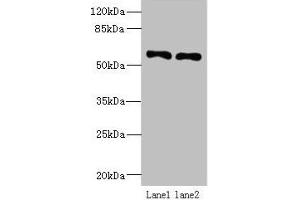 Western blot All lanes: IFRD2 antibody at 12 μg/mL Lane 1: Hela whole cell lysate Lane 2: PC-3 whole cell lysate Secondary Goat polyclonal to rabbit IgG at 1/10000 dilution Predicted band size: 55, 66 kDa Observed band size: 55 kDa (IFRD2 抗体  (AA 1-202))