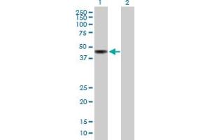 Western Blot analysis of KIAA0774 expression in transfected 293T cell line by KIAA0774 MaxPab polyclonal antibody.