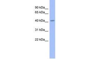 Image no. 1 for anti-Gastrulation Brain Homeo Box 2 (GBX2) (AA 179-228) antibody (ABIN6742290) (GBX2 抗体  (AA 179-228))