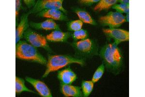 HeLa cell cultures stained with Ubiquilin 2 / UBQLN2 antibody (green) and chicken polyclonal antibody to vimentin (red). (Ubiquilin 2 抗体)