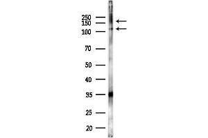 anti-Zinc Finger Protein GLI1 (GLI1) (C-Term) antibody
