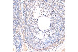 Immunohistochemistry of paraffin-embedded rat ovary using SM antibody (ABIN6128714, ABIN6148090, ABIN6148091 and ABIN6218232) at dilution of 1:200 (40x lens). (SMAD5 抗体  (AA 186-465))