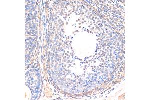 Immunohistochemistry of paraffin-embedded rat ovary using SM antibody (ABIN6128714, ABIN6148090, ABIN6148091 and ABIN6218232) at dilution of 1:200 (40x lens).