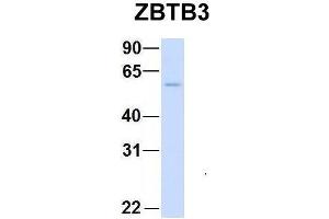 Host:  Rabbit  Target Name:  CHAD  Sample Type:  Human Adult Placenta  Antibody Dilution:  1. (ZBTB3 抗体  (Middle Region))