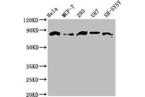 Western Blot Positive WB detected in: Hela whole cell lysate, MCF-7 whole cell lysate, 293 whole cell lysate, U87 whole cell lysate, SH-SY5Y whole cell lysate All lanes: BARD1 antibody at 3. (BARD1 抗体  (AA 428-777))