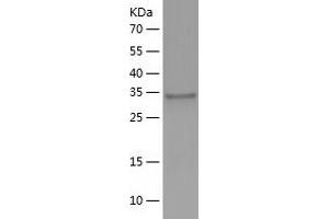 Western Blotting (WB) image for Interleukin 12 (IL12) (AA 23-335) protein (His tag) (ABIN7123545)