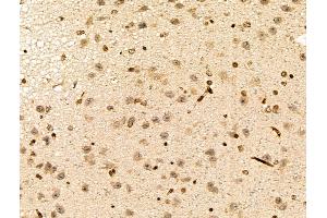 anti-MutL Homolog 3 (MLH3) (Internal Region) antibody