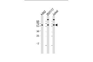 All lanes : Anti-Hsp 60 Antibody (N-term) at 1:2000 dilution Lane 1: K562 whole cell lysate Lane 2: 293T/17 whole cell lysate Lane 3: Jurkat whole cell lysate Lysates/proteins at 20 μg per lane. (HSPD1 抗体  (N-Term))