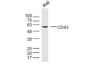 Raji cell lysates probed with CD43 Polyclonal Antibody, unconjugated  at 1:300 overnight at 4°C followed by a conjugated secondary antibody for 60 minutes at 37°C. (CD43 抗体  (AA 101-200))
