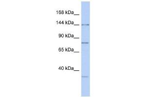 RNASEN antibody used at 1 ug/ml to detect target protein. (DROSHA 抗体  (Middle Region))
