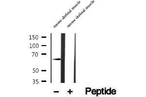 Western blot analysis of extracts of mouse skeletal muscle tissue, using CRAT antibody.