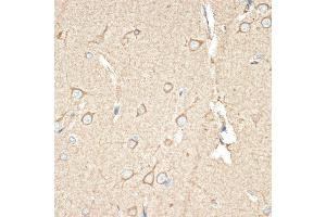 Immunohistochemistry of paraffin-embedded human brain using B Rabbit mAb (ABIN1680181, ABIN7101458, ABIN7101459 and ABIN7101460) at dilution of 1:100 (40x lens). (BCAP31 抗体)