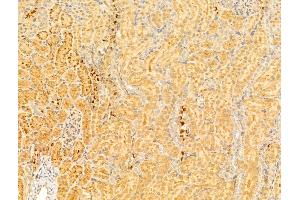 ABIN6264149 and ABIN6273012 at 1/100 staining Rat kidney tissue by IHC-P.