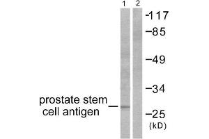 Western Blotting (WB) image for anti-Prostate Stem Cell Antigen (PSCA) (Internal Region) antibody (ABIN1848753) (PSCA 抗体  (Internal Region))