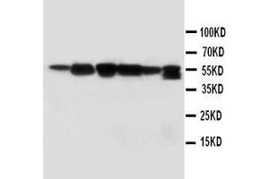 Anti-ABI1 antibody, Western blotting Lane 1: Rat Liver Tissue Lysate Lane 2: Rat Brain Tissue Lysate Lane 3: MM231 Cell Lysate Lane 4: HELA Cell Lysate Lane 5: SMMC Cell Lysate  Lane 6: JURKAT Cell Lysate (ABI1 抗体  (C-Term))