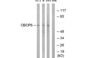 Western blot analysis of extracts from HeLa cells, Jurkat cells and A549 cells, using CBCP6 antibody. (AGBL4 抗体)