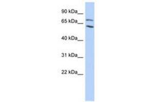 Image no. 1 for anti-Metastasis Associated 1 Family, Member 2 (MTA2) (AA 35-84) antibody (ABIN6740437)