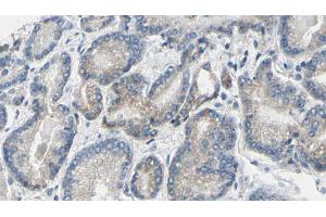 ABIN6269275 at 1/100 staining Human prostate tissue by IHC-P. (GSK3 alpha 抗体  (N-Term))
