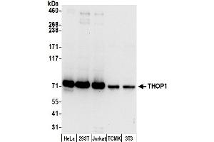 anti-Thimet Oligopeptidase 1 (THOP1) (AA 25-75) antibody
